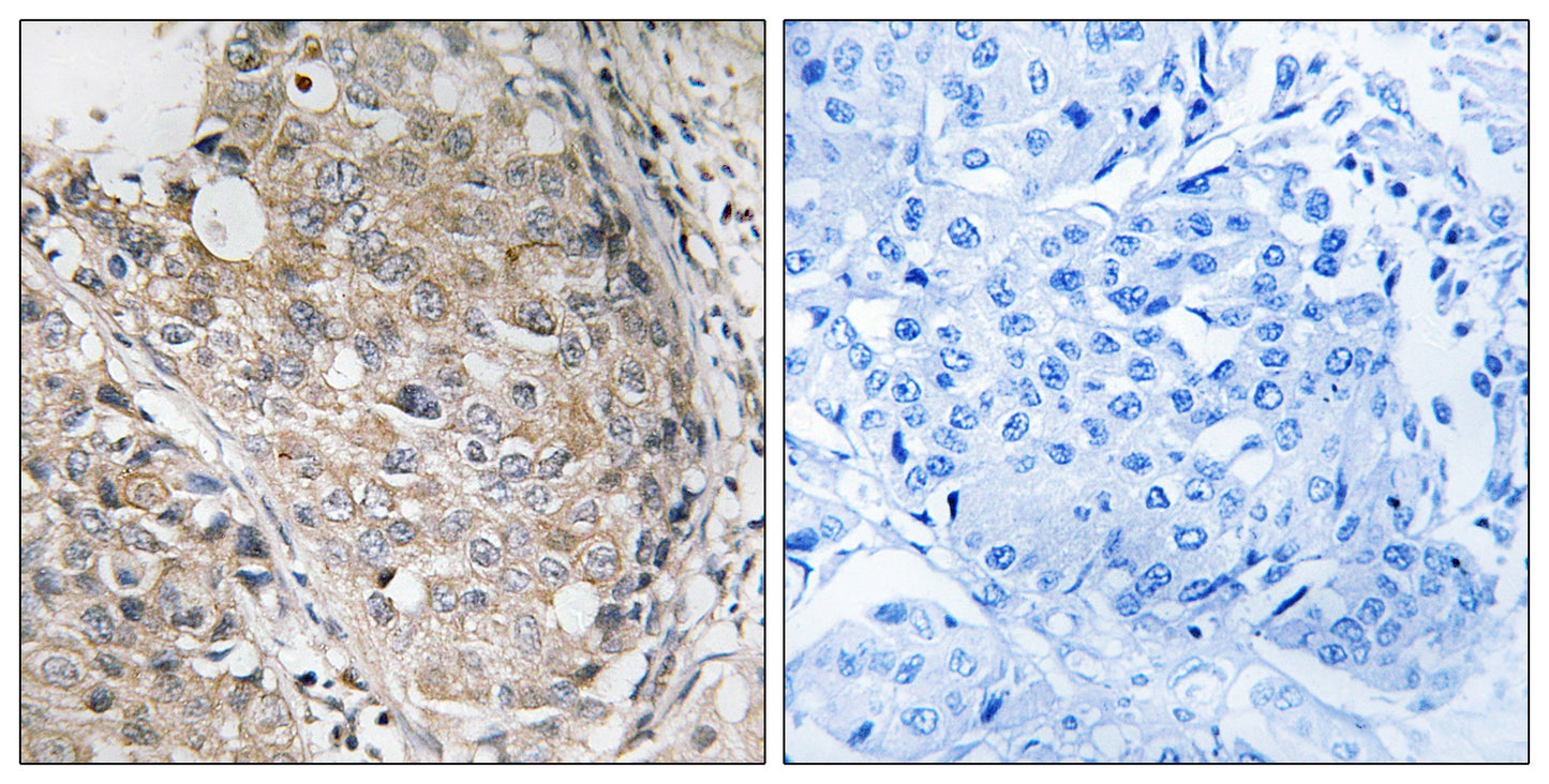MKP-1/2 Rabbit Polyclonal Antibody