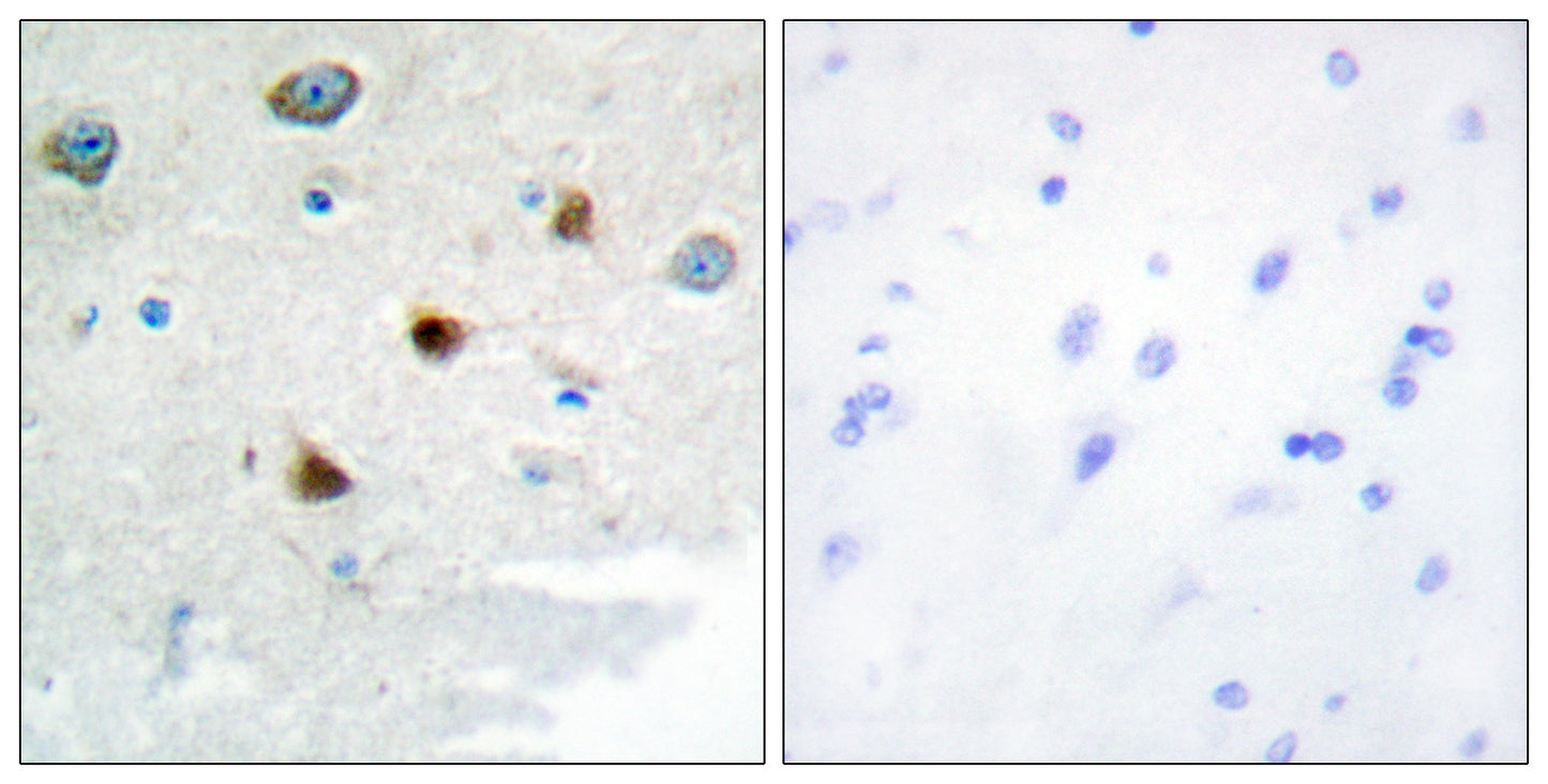 MKP-2 Rabbit Polyclonal Antibody