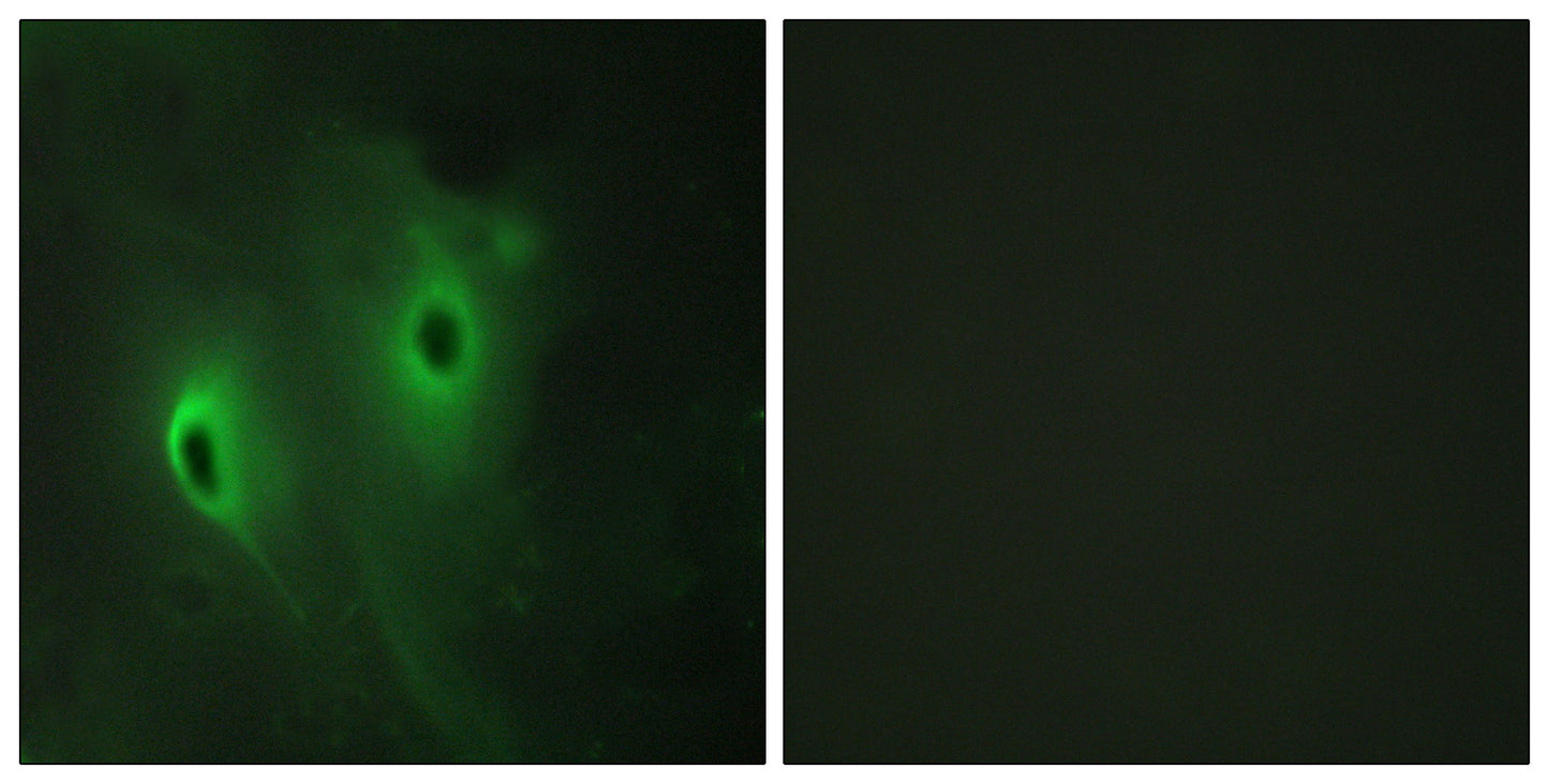 MKP-4 Rabbit Polyclonal Antibody