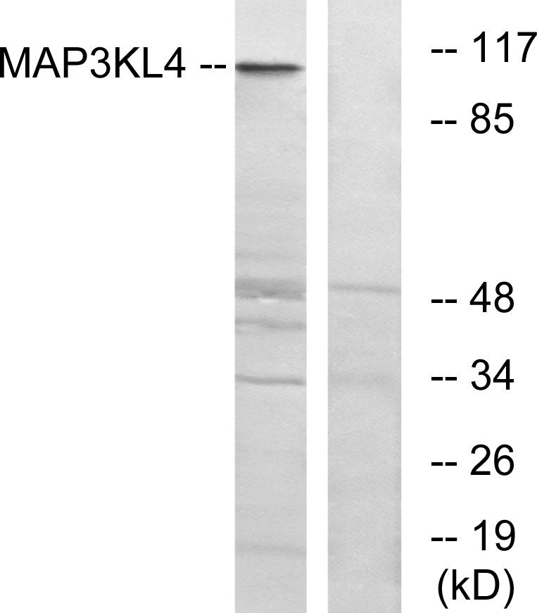 MLK4 Rabbit Polyclonal Antibody