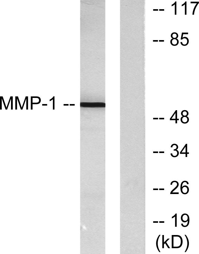 MMP-1 Rabbit Polyclonal Antibody