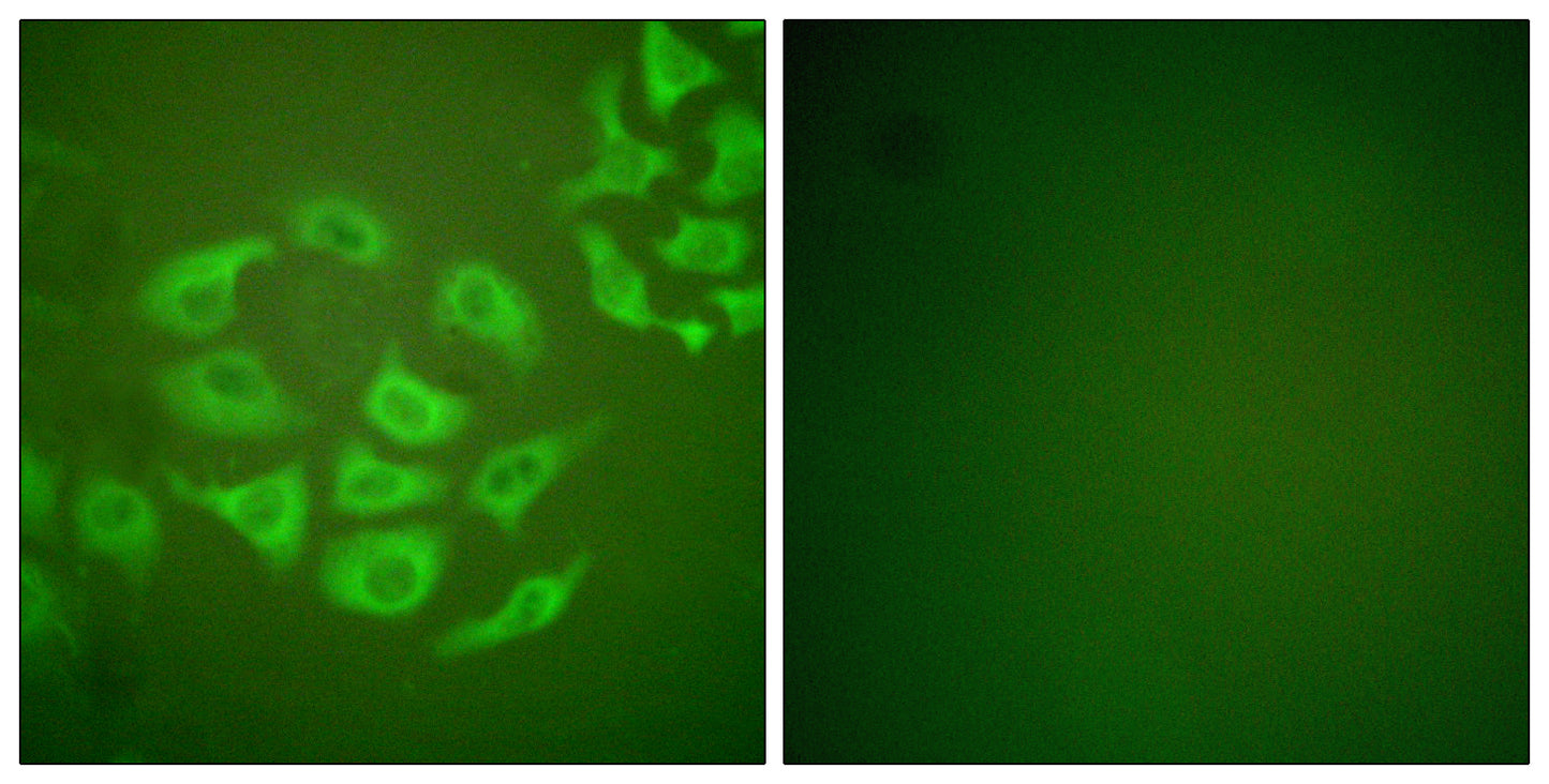 MMP-10 Rabbit Polyclonal Antibody
