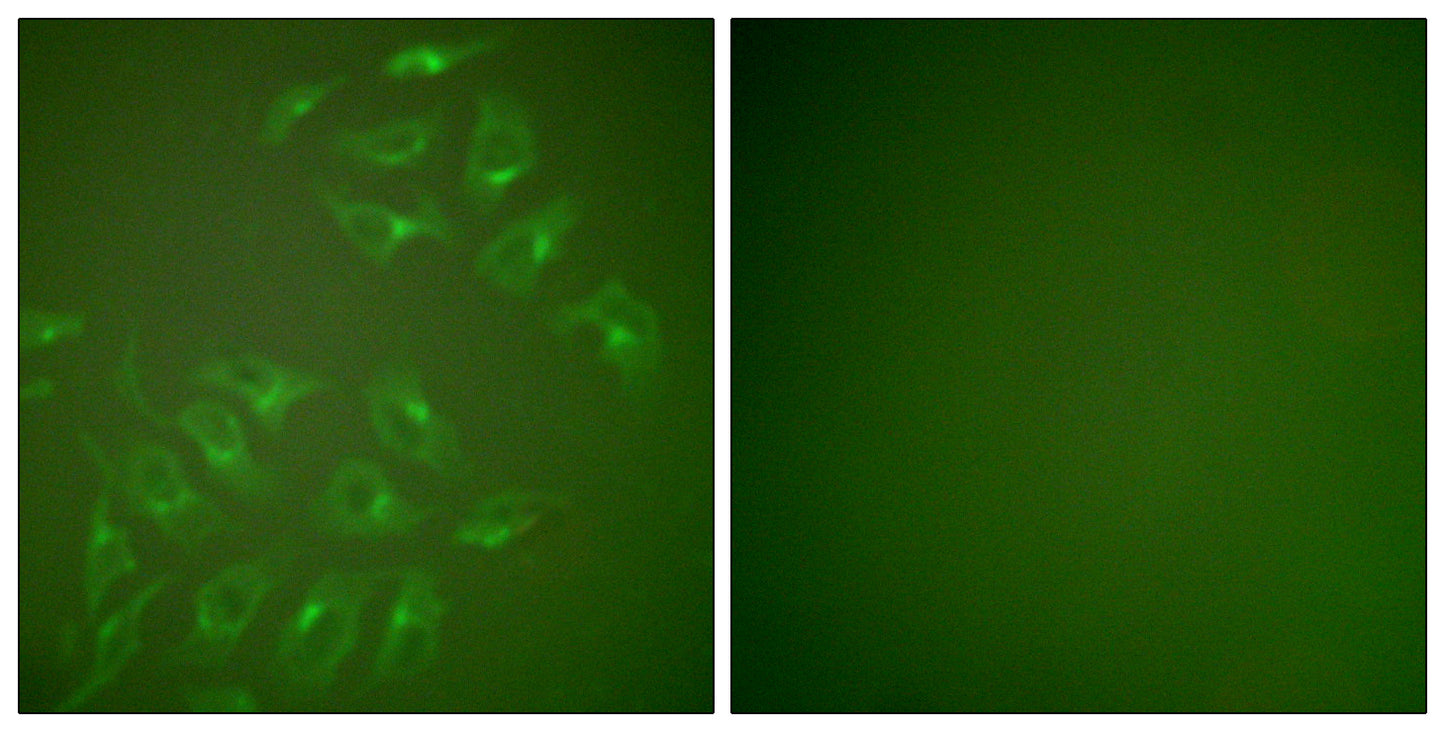 MMP-13 Rabbit Polyclonal Antibody