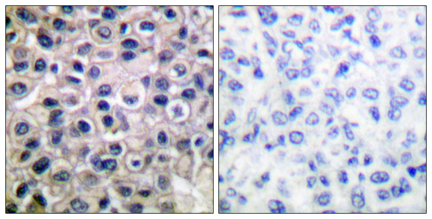 MMP-14 Rabbit Polyclonal Antibody