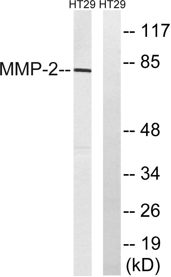 MMP-2 Rabbit Polyclonal Antibody