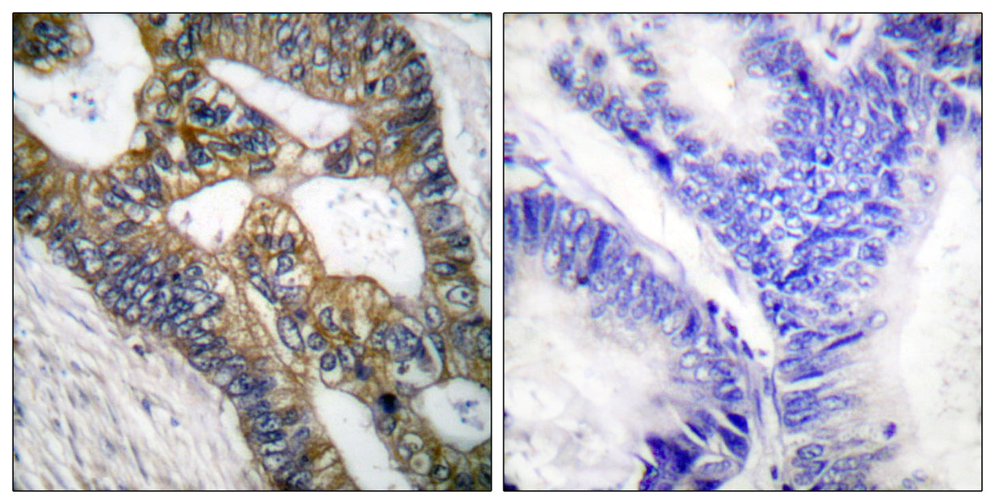 MMP-7 Rabbit Polyclonal Antibody