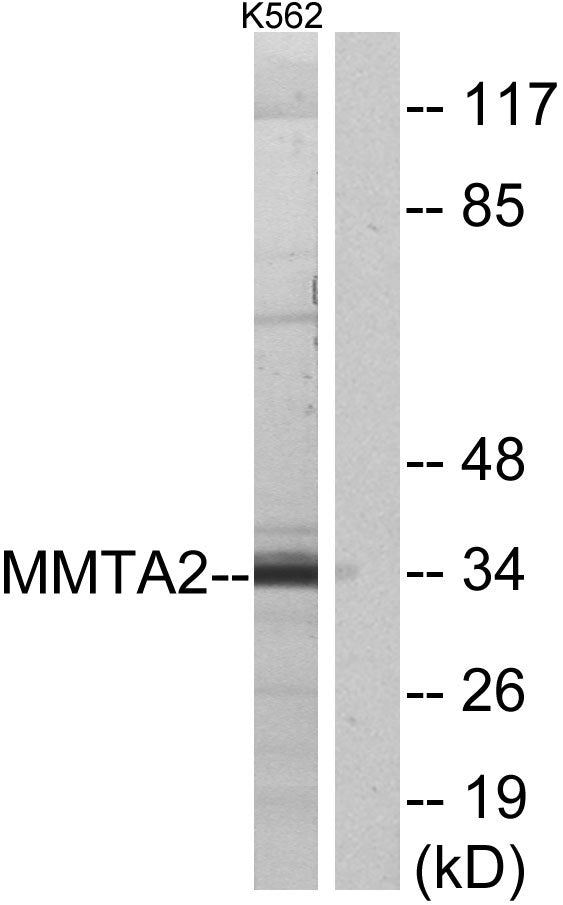 MMTAG2 Rabbit Polyclonal Antibody