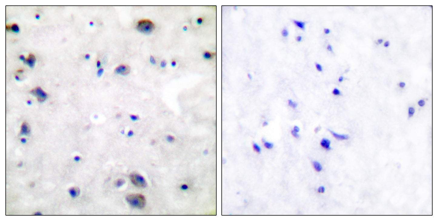 MOR-1 Rabbit Polyclonal Antibody