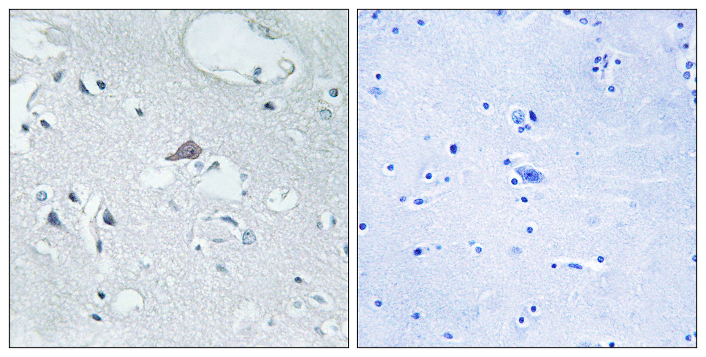 MOR-1 Rabbit Polyclonal Antibody