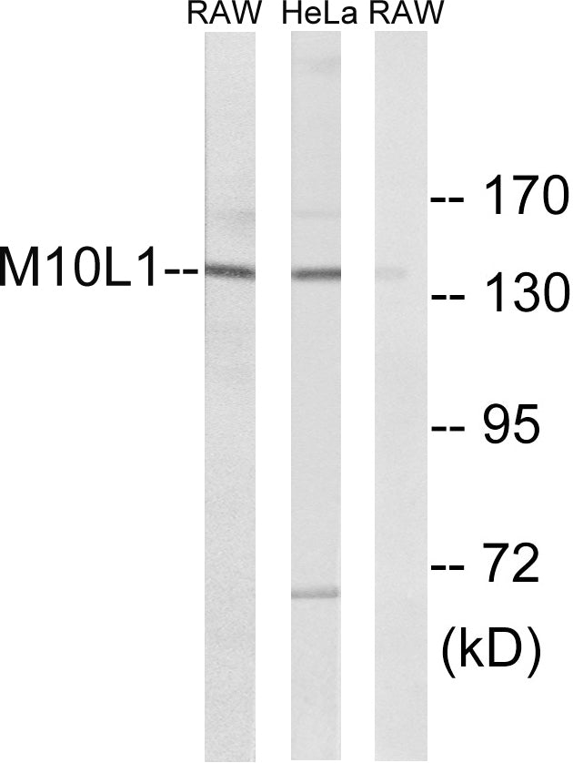MOV10L1 Rabbit Polyclonal Antibody