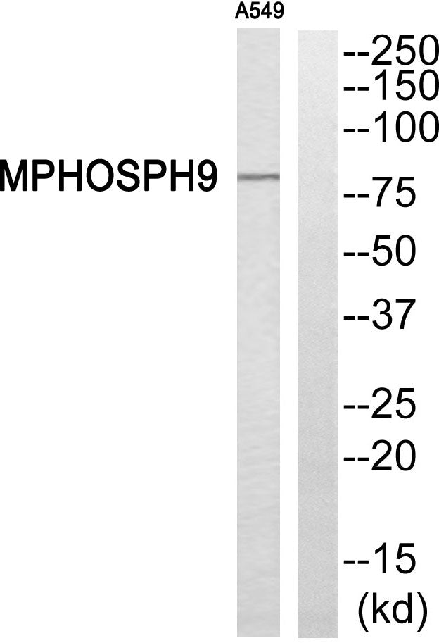 MPP9 Rabbit Polyclonal Antibody