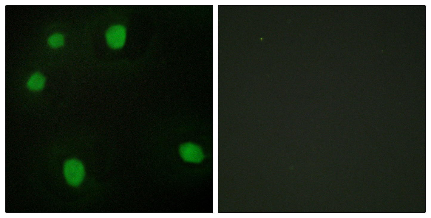 MRG15 Rabbit Polyclonal Antibody