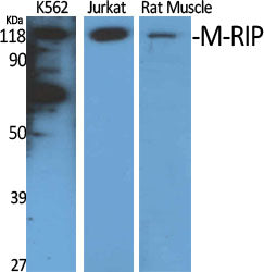 M-RIP Rabbit Polyclonal Antibody