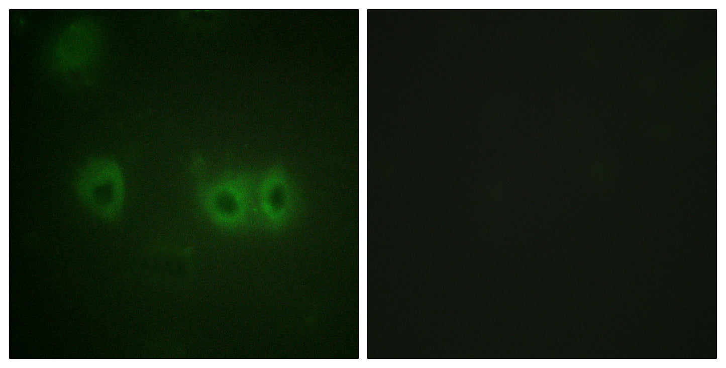 MRLC2 Rabbit Polyclonal Antibody