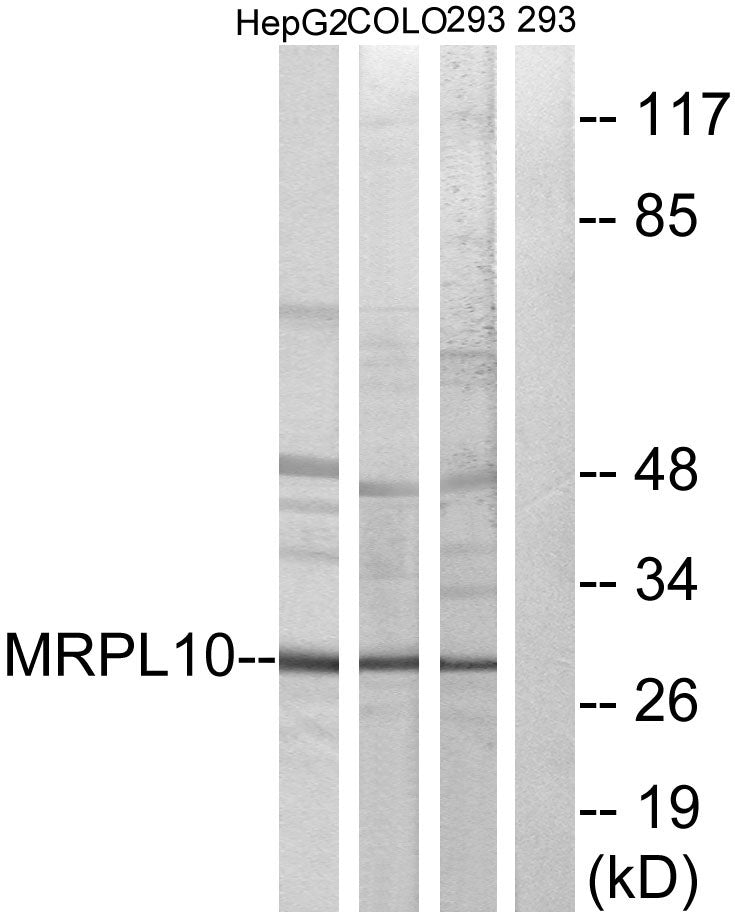 MRP-L10 Rabbit Polyclonal Antibody