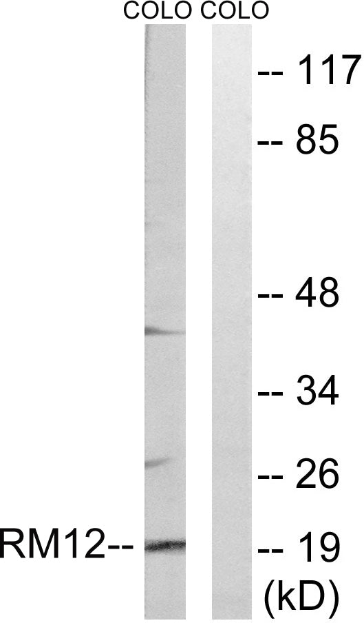 MRP-L12 Rabbit Polyclonal Antibody