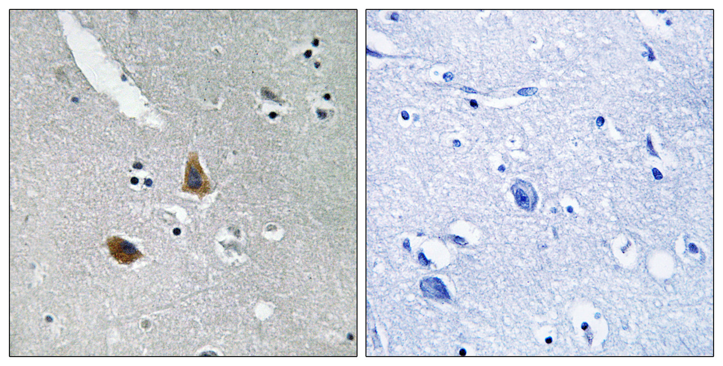 MRP-L21 Rabbit Polyclonal Antibody