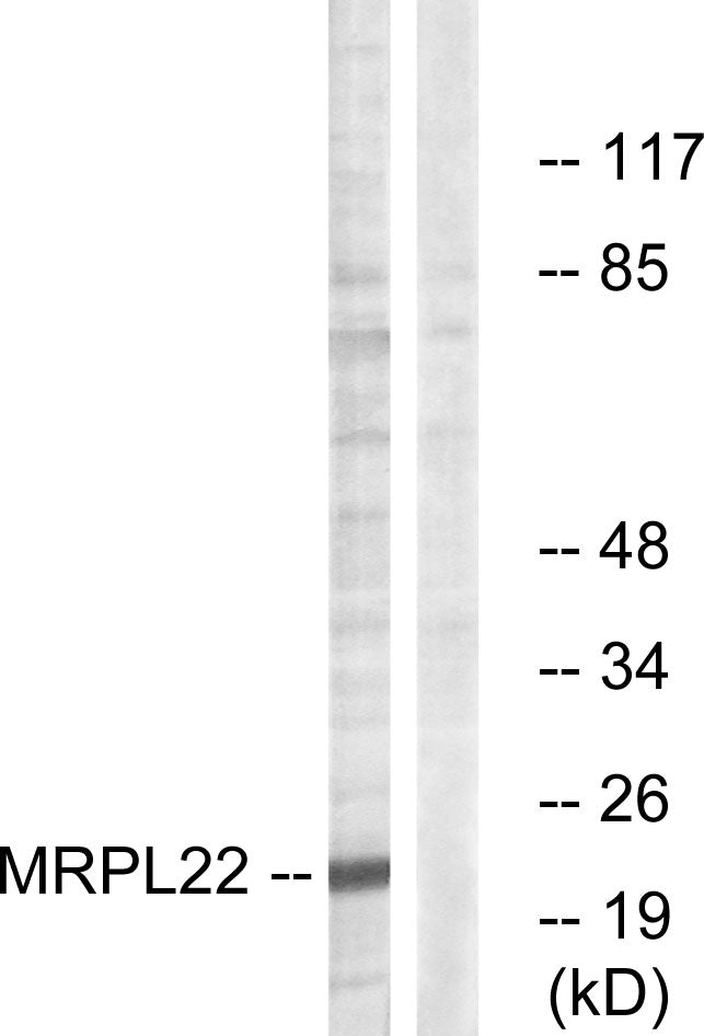 MRP-L22 Rabbit Polyclonal Antibody