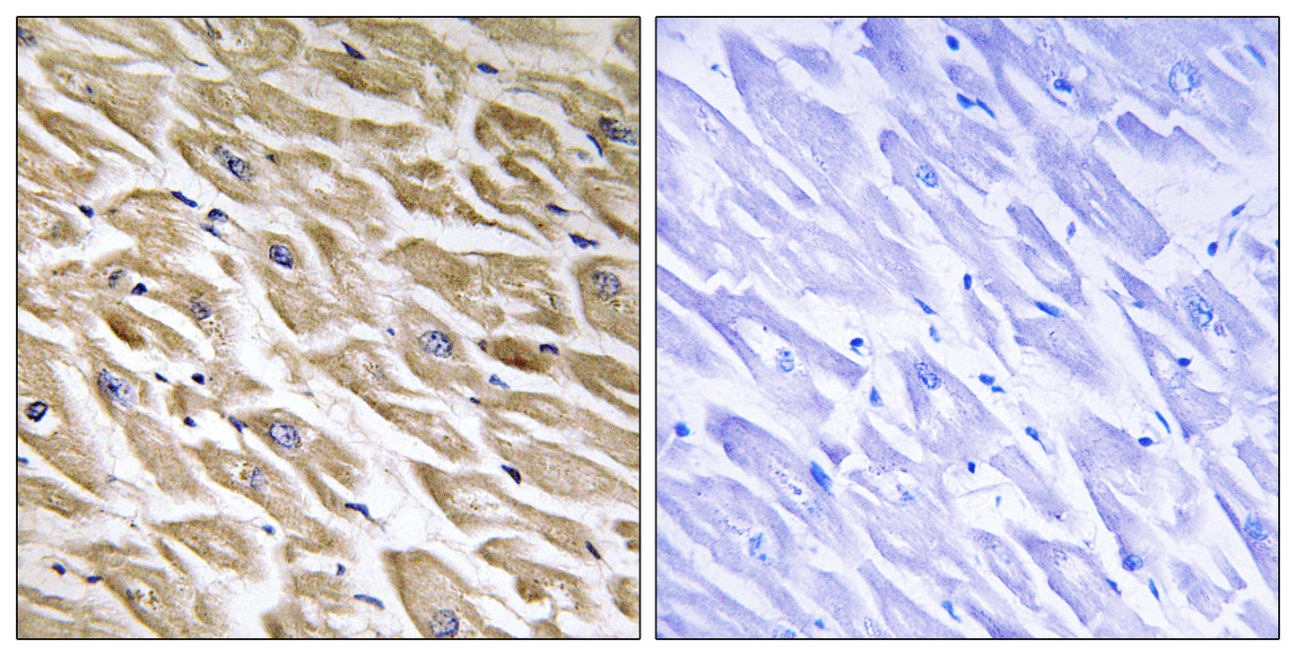 MRP-L39 Rabbit Polyclonal Antibody