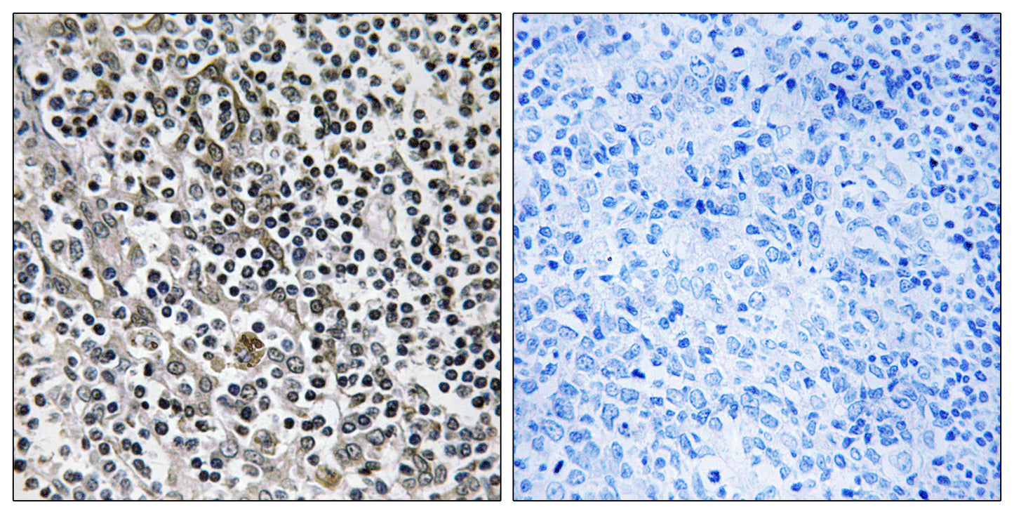 MRP-L51 Rabbit Polyclonal Antibody