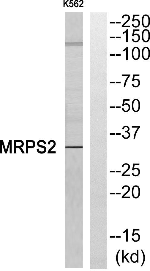 MRP-S2 Rabbit Polyclonal Antibody