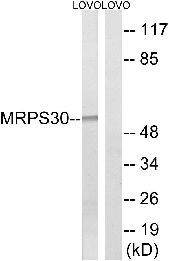 MRP-S30 Rabbit Polyclonal Antibody