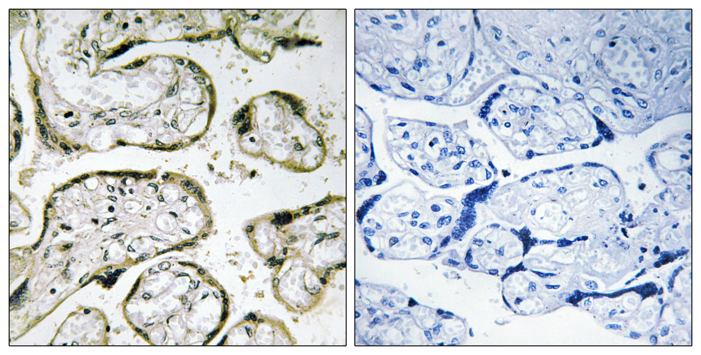 MRP-S32 Rabbit Polyclonal Antibody