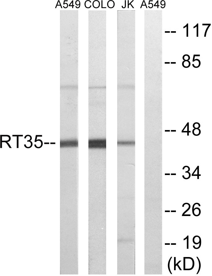 MRP-S35 Rabbit Polyclonal Antibody