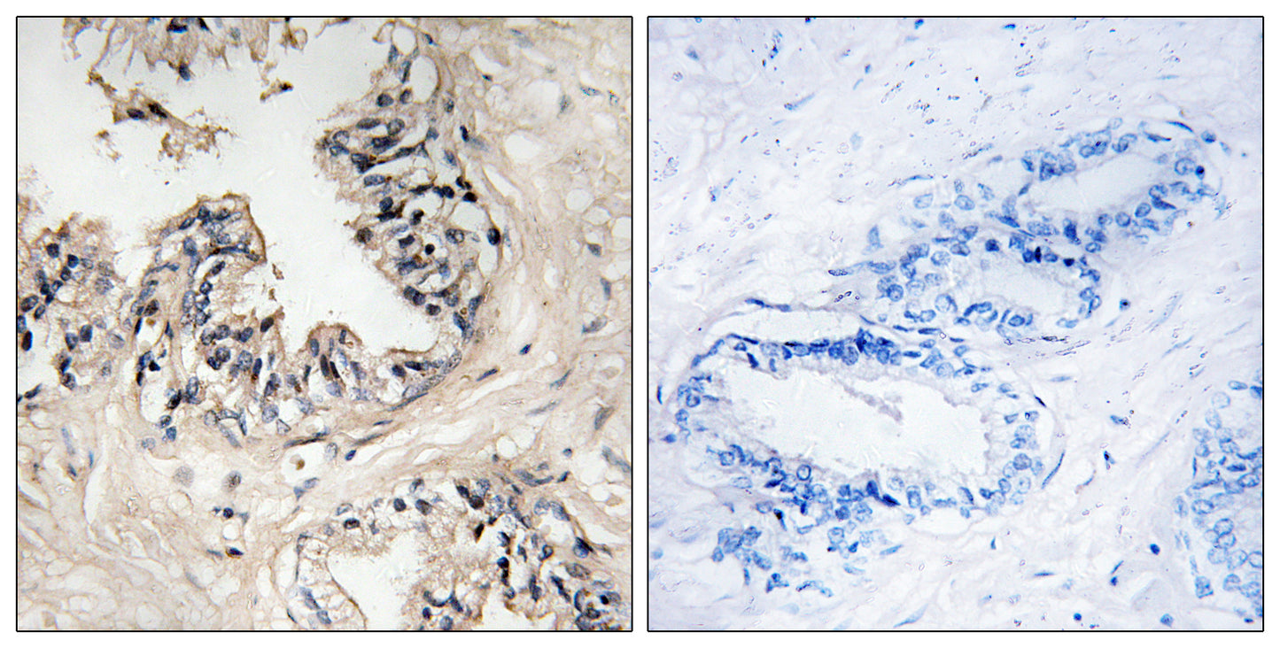 MRP-S36 Rabbit Polyclonal Antibody