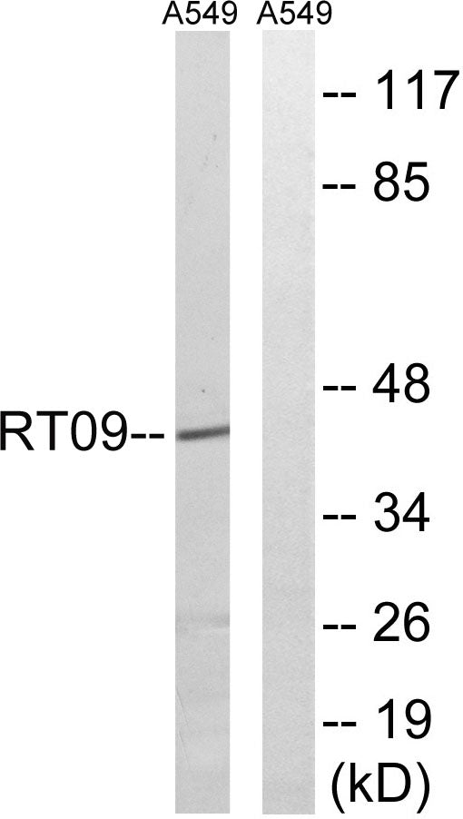 MRP-S9 Rabbit Polyclonal Antibody