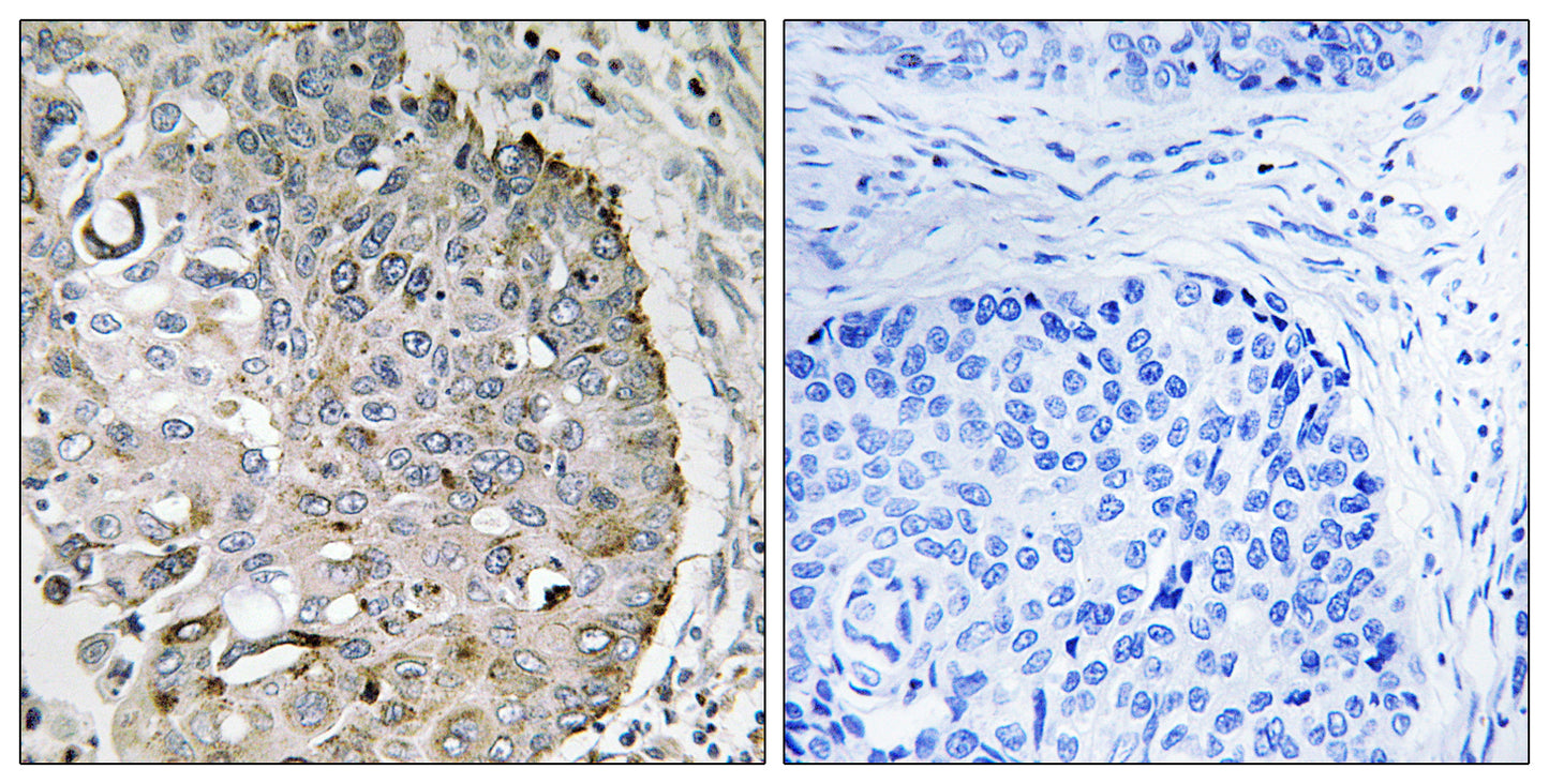MRRF Rabbit Polyclonal Antibody