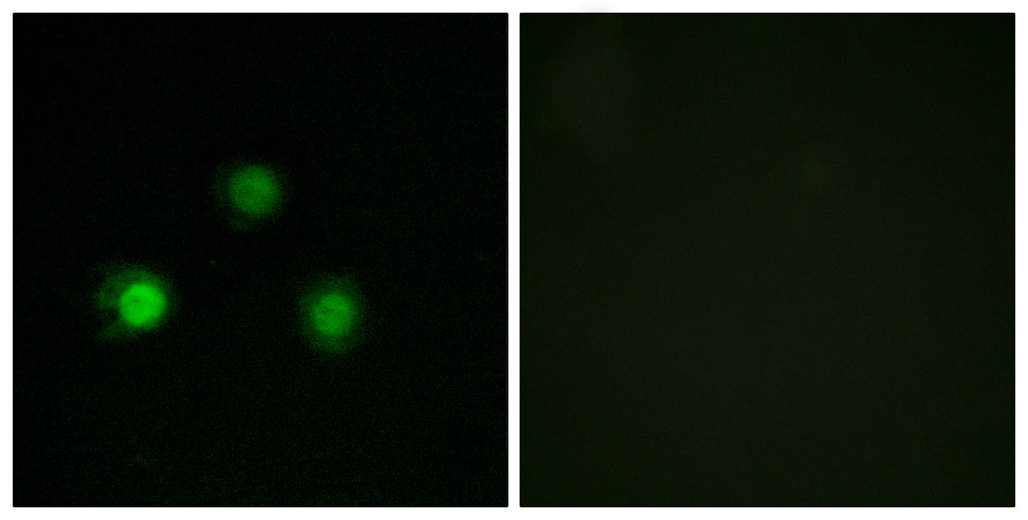 MSH2 Rabbit Polyclonal Antibody