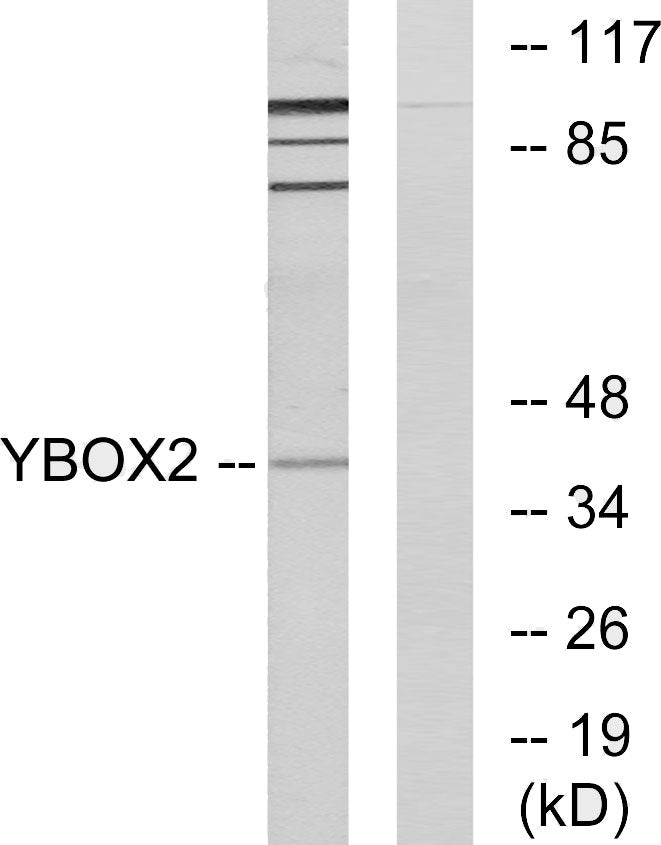 MSY2 Rabbit Polyclonal Antibody