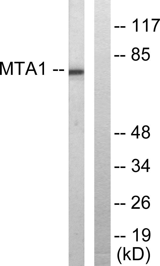 MTA1 Rabbit Polyclonal Antibody