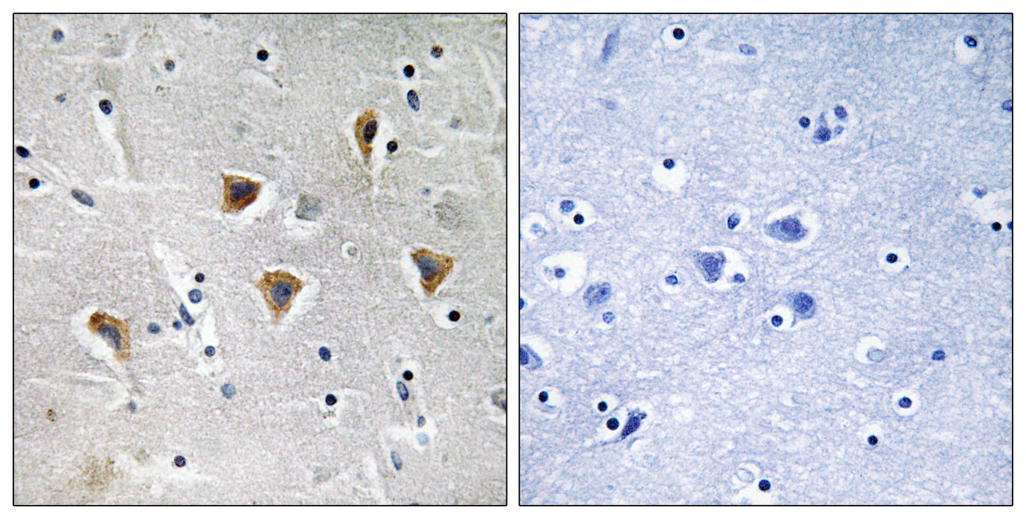 mTERF Rabbit Polyclonal Antibody