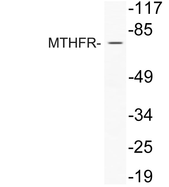 MTHFR Rabbit Polyclonal Antibody