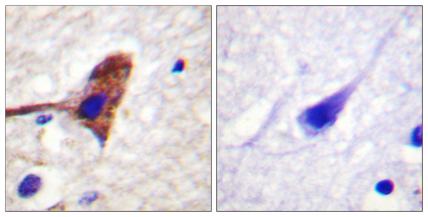 mTOR Rabbit Polyclonal Antibody