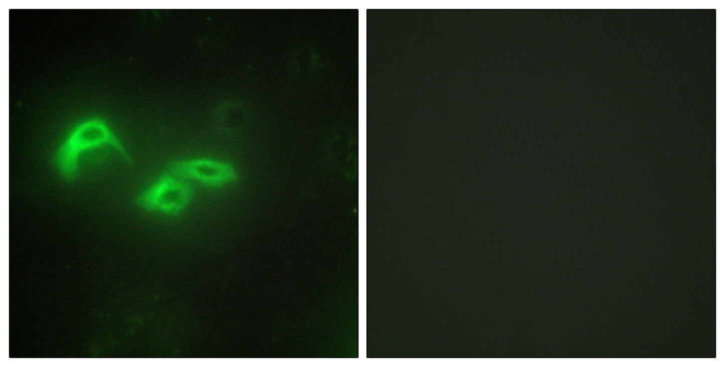 mtTFA Rabbit Polyclonal Antibody