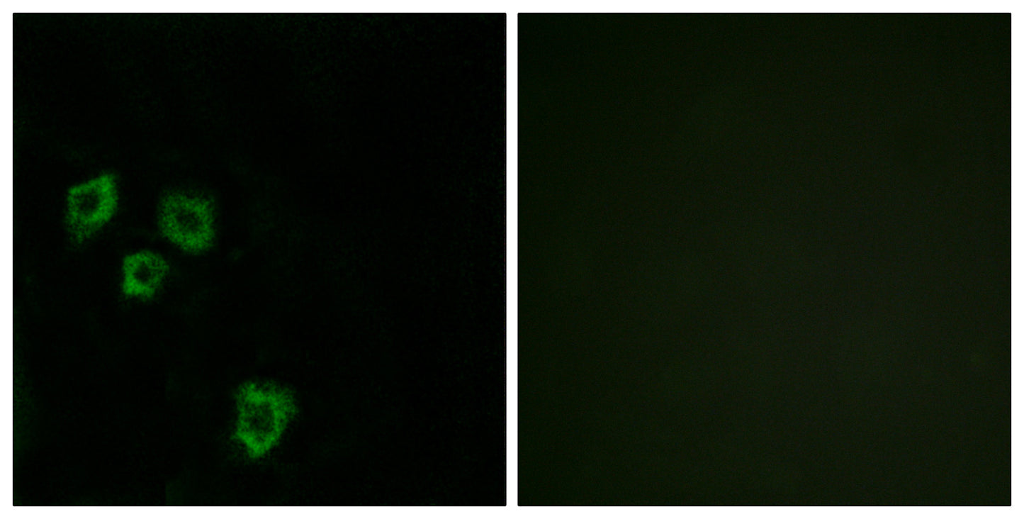 Mucin 16 Rabbit Polyclonal Antibody