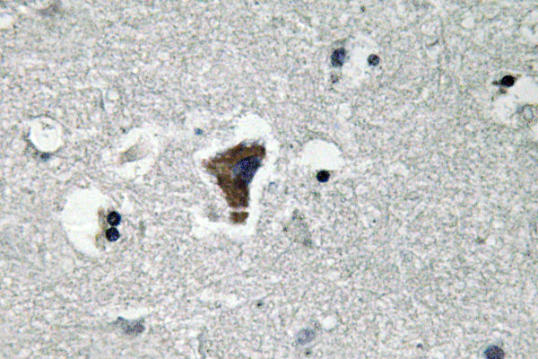 MyD88 Rabbit Polyclonal Antibody