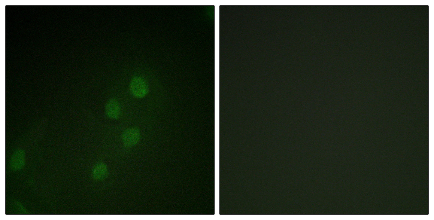 Myf-5 Rabbit Polyclonal Antibody
