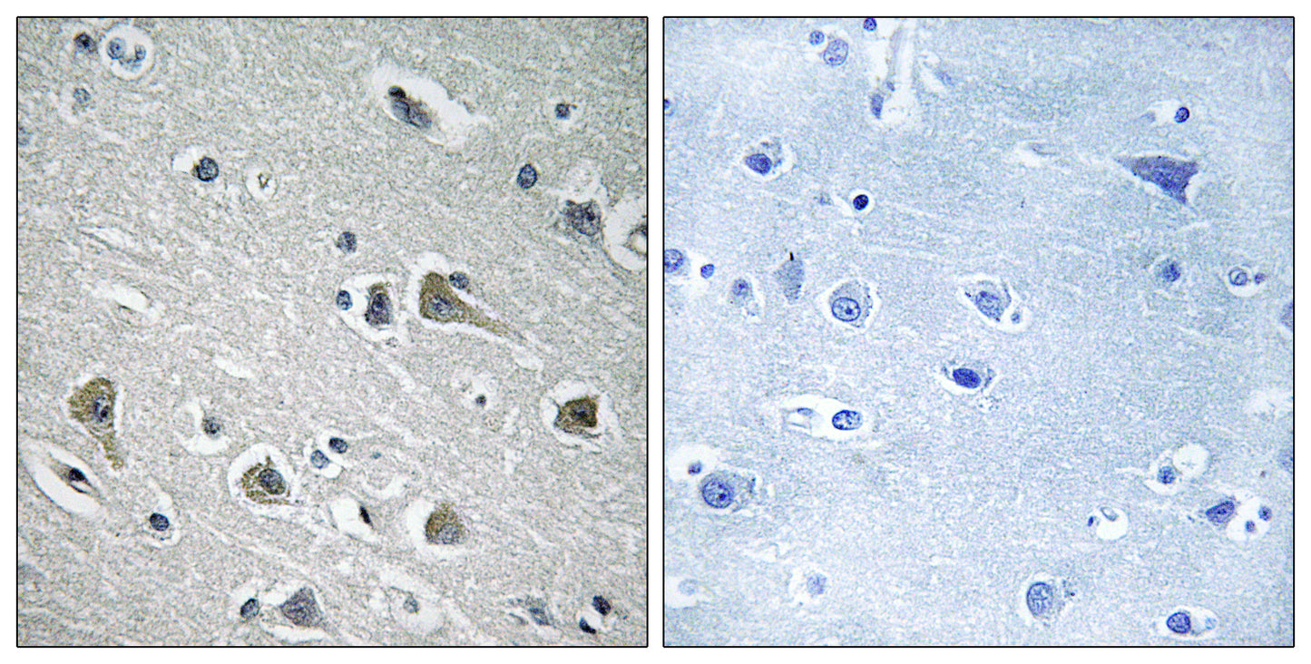 MYLIP Rabbit Polyclonal Antibody