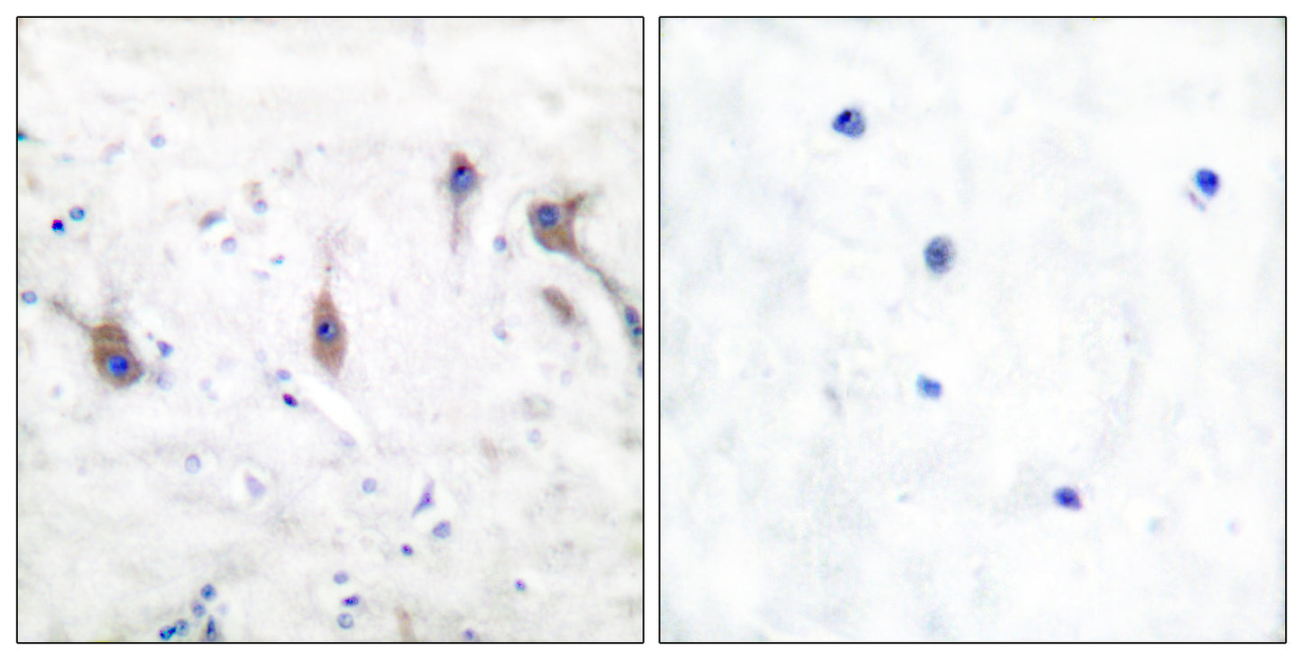 Myp Rabbit Polyclonal Antibody