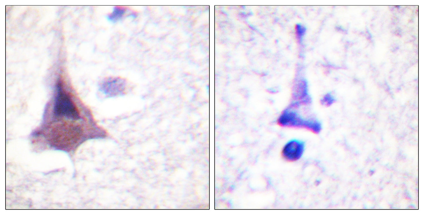 MYPT1 Rabbit Polyclonal Antibody