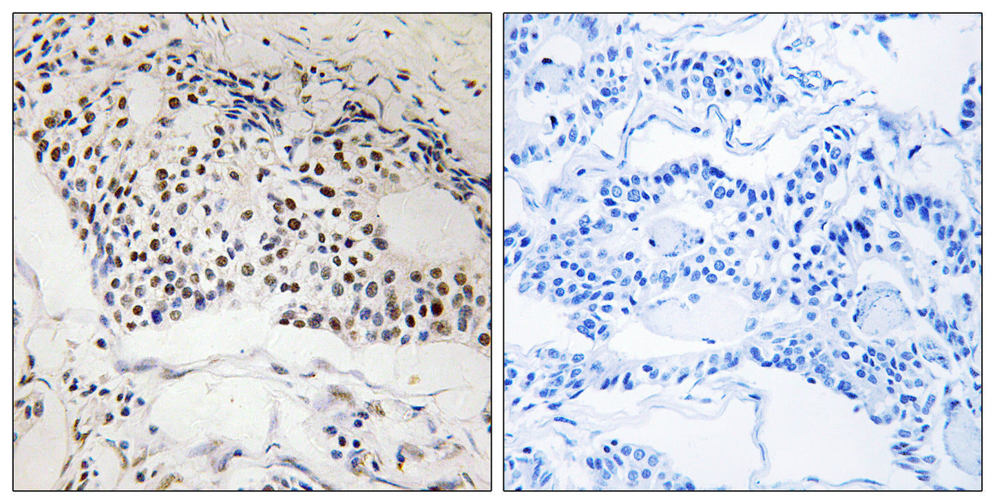 MYSM1 Rabbit Polyclonal Antibody