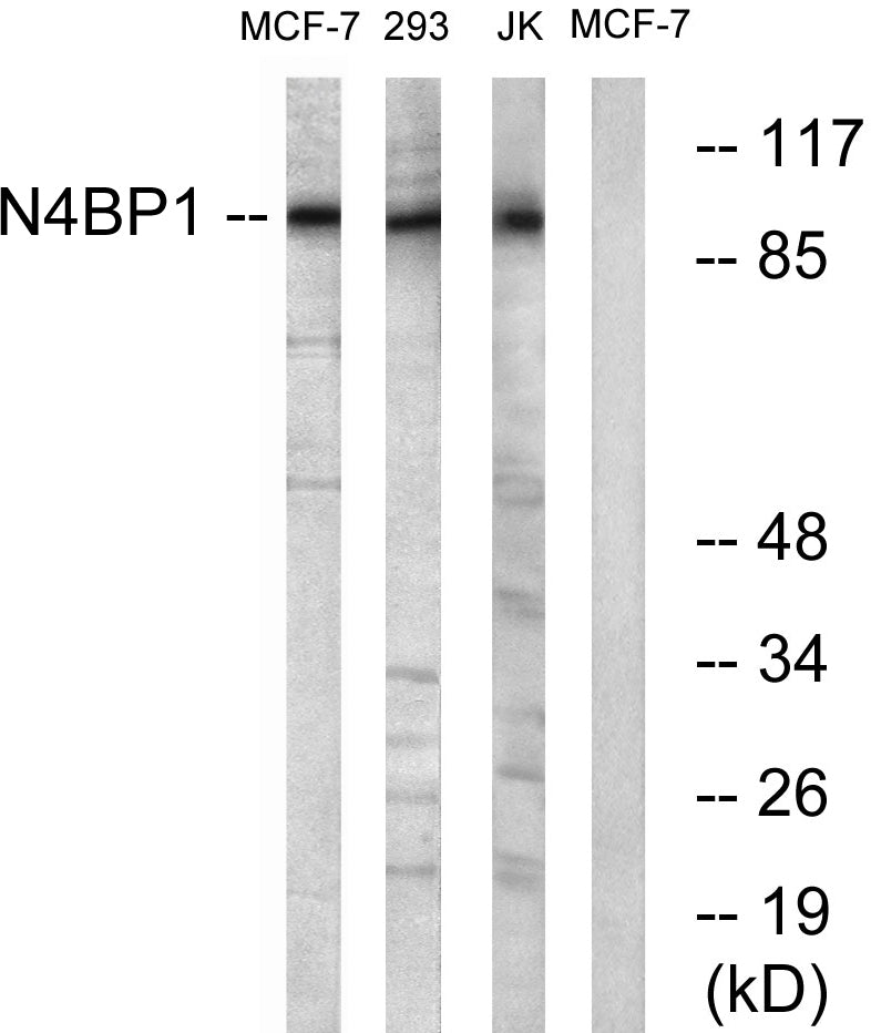 N4BP1 Rabbit Polyclonal Antibody