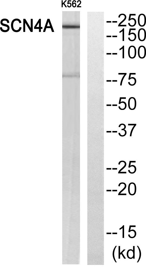 Na+ CP type IVα Rabbit Polyclonal Antibody