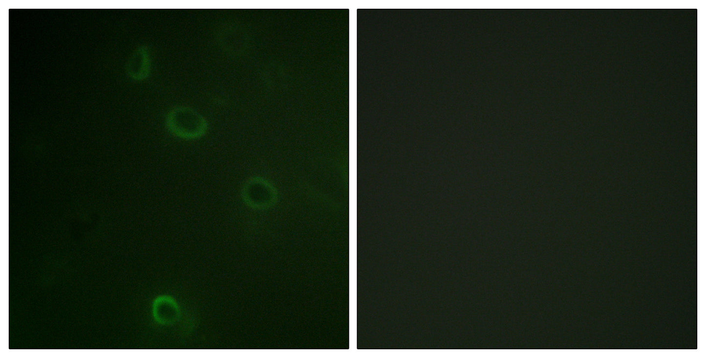 Na+/K+-ATPase α1 Rabbit Polyclonal Antibody
