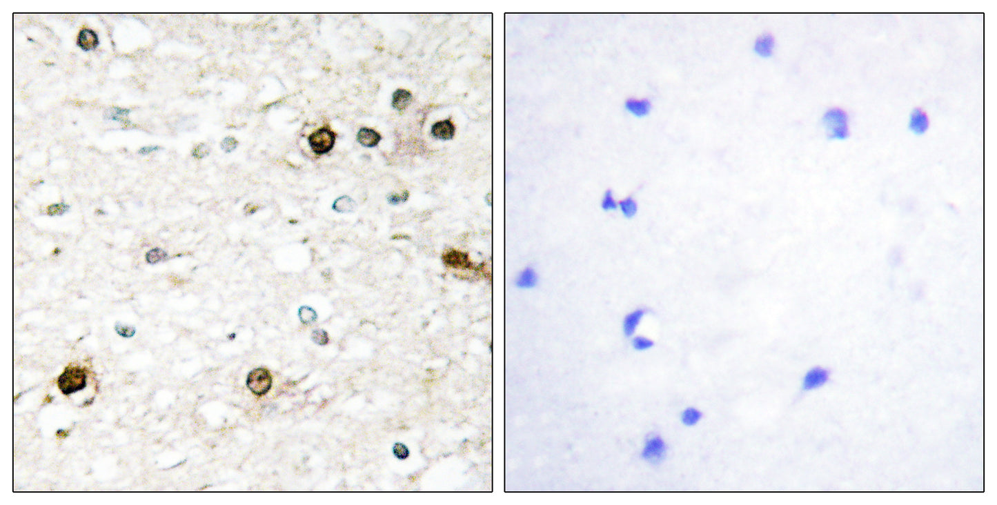 NAB2 Rabbit Polyclonal Antibody