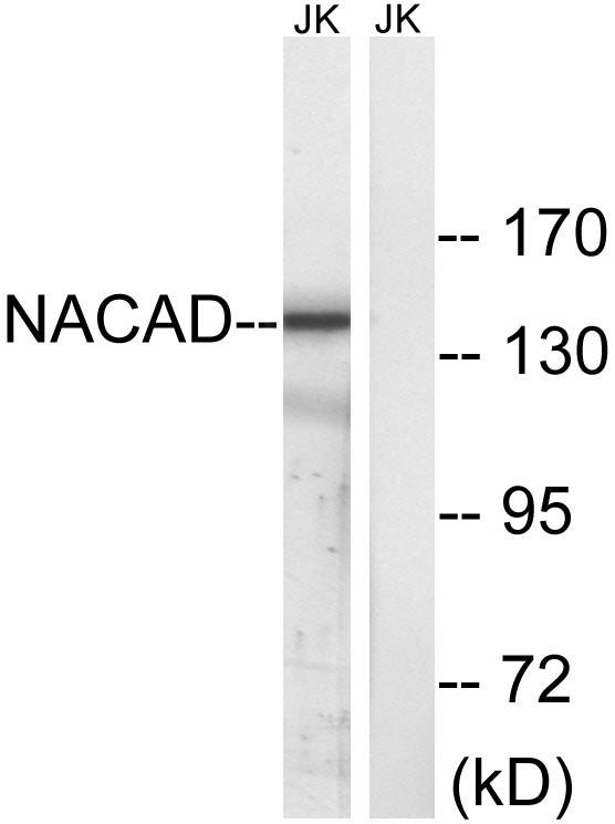 NACAD Rabbit Polyclonal Antibody
